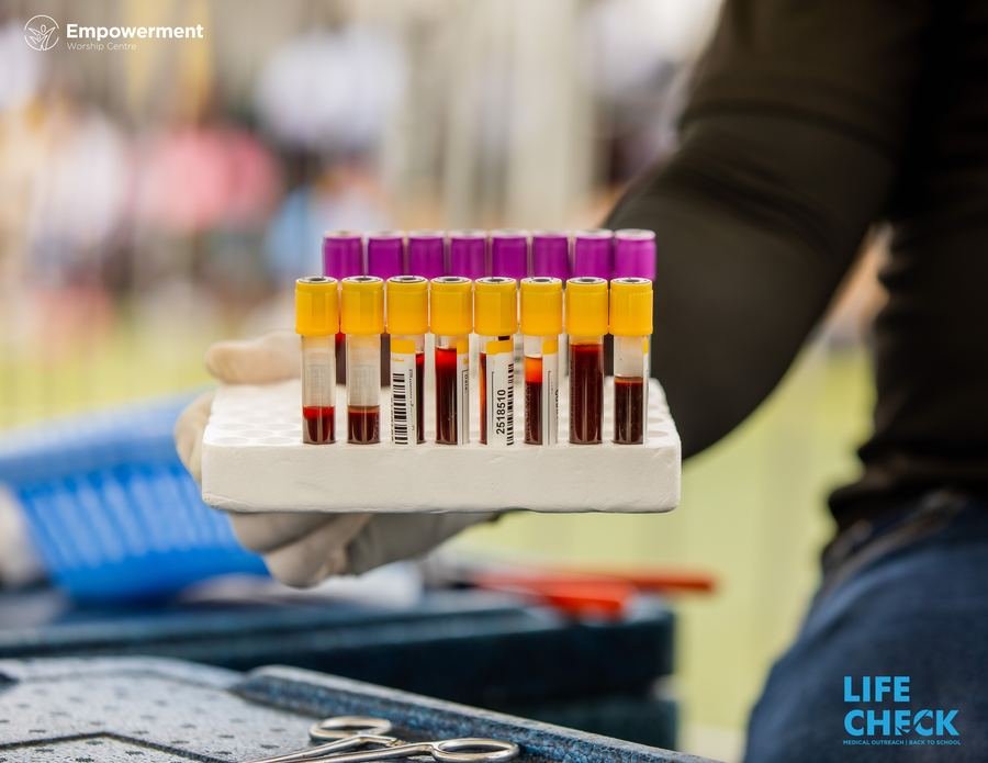 Laboratory screening samples at LifeCheck 2025